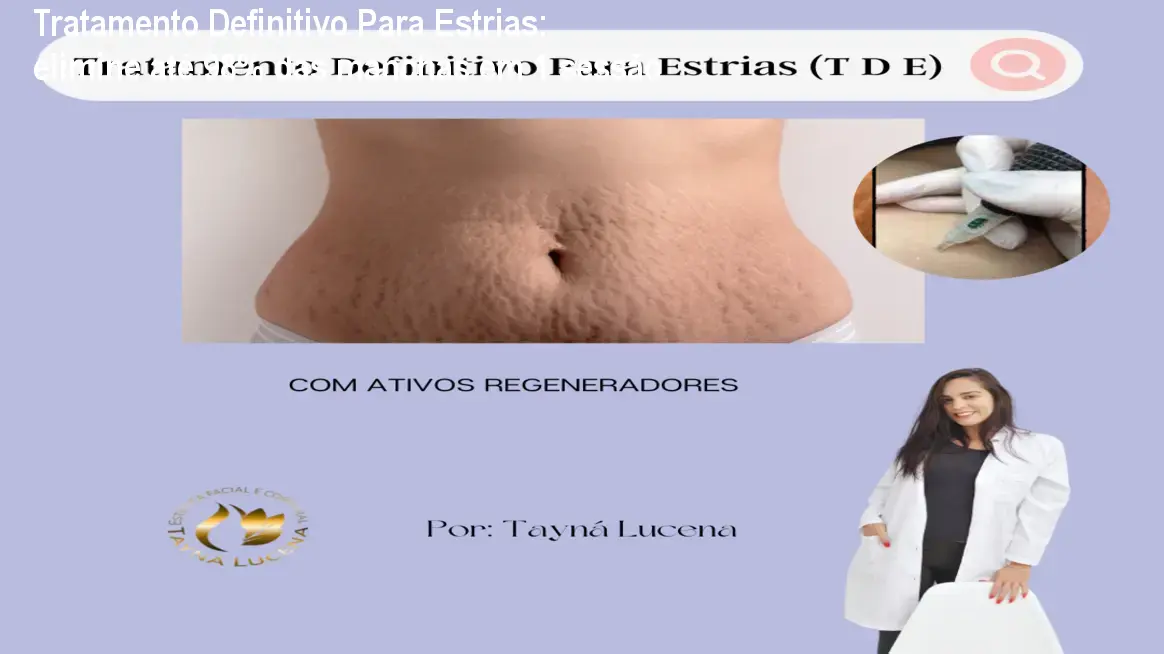 Imagem mostrando a aplicação prática do método TDE que reduz estrias visíveis na pele