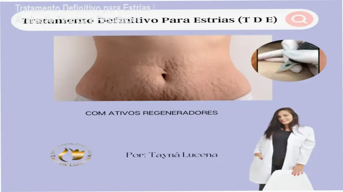 Imagem ilustrando a técnica de permeabilização dérmica para tratamento de estrias