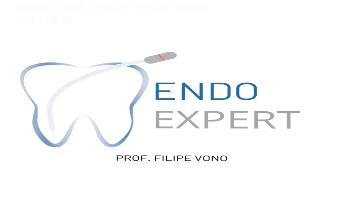 Dr. Filipe apresentando o Kit de Limas do Método VONO para endodontia complexa