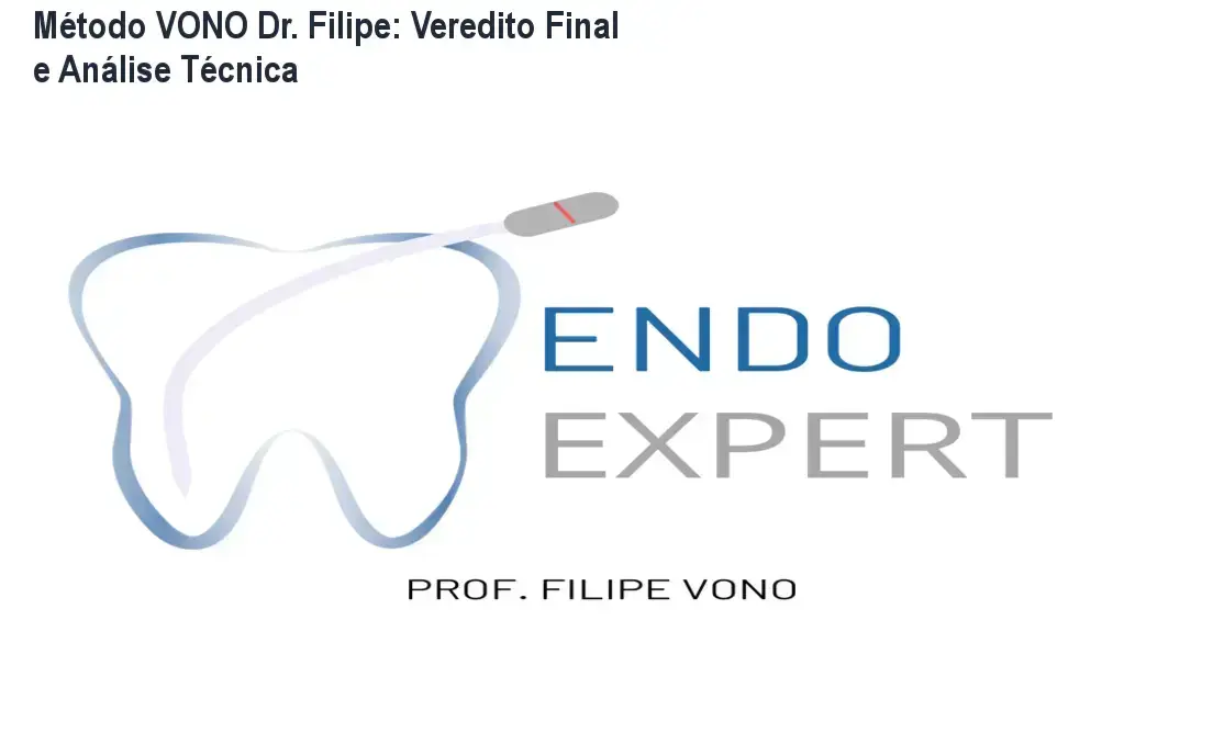 metodo vono dr filipe kit limas endodontia Método VONO Dr. Filipe: Veredito Final e Análise Técnica Kit de limas do Método VONO para instrumentação endodôntica mecanizada